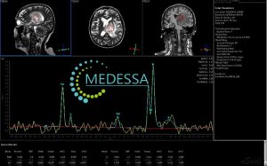 МР-спектроскопія