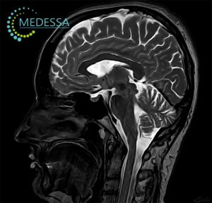 МРТ-діагностика голови та шиї