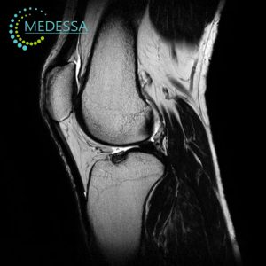 МРТ суглобів та м’яких тканин