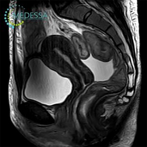 МРТ внутрішніх органів та малого тазу