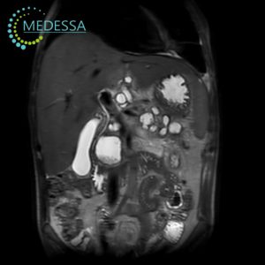 MRI of the Abdominal Organs