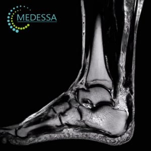 МРТ гомілковостопного суглоба Одеса