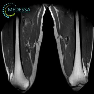 МРТ стегна Одеса