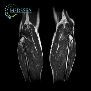 МРТ гомілки Одеса