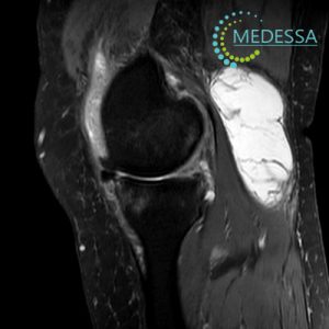 МРТ в одессе коленный сустав