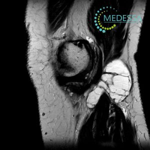 МРТ Одеса колено