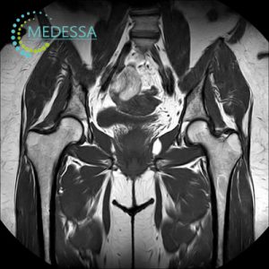 МРТ кульшових суглобів Одеса